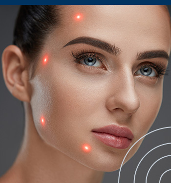 Laserterapia Aplicada à Fonoaudiologia | Turma 4
