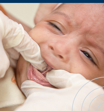 Atua&ccedil;&atilde;o Fonoaudiol&oacute;gica em Freios Orais | Turma 1